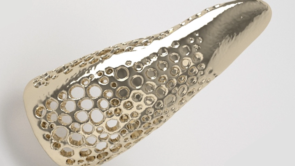 Irene Healey’s prosthetic thumb design, combining scientific precision and artistic innovation