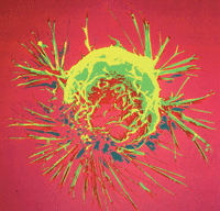 El gen BRCA-1 está ligado a la susceptibilidad de cáncer de mama y de ovario. (Crédito:  RCSB PDB)