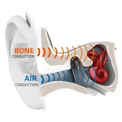 Shenzhen Shokz: la tecnología de conducción ósea en aras de una nueva  experiencia auditiva