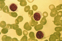 Le Dr Golde a établi, à partir de tissus prélevés après ablation sur la rate de M. Moore, une lignée cellulaire qu’il a brevetée. Aurait-il dû demander le consentement de M. Moore? (Photo : U.S. National Cancer Institute)